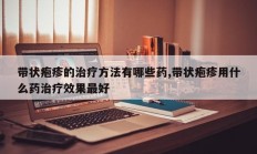 带状疱疹的治疗方法有哪些药,带状疱疹用什么药治疗效果最好