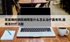 耳面瘫的病因病理是什么怎么治疗最有效,面瘫耳针疗法图
