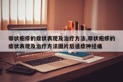 带状疱疹的症状表现及治疗方法,带状疱疹的症状表现及治疗方法图片后遗症神经痛