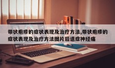 带状疱疹的症状表现及治疗方法,带状疱疹的症状表现及治疗方法图片后遗症神经痛
