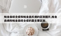 帕金森综合症和帕金森氏病的区别图片,帕金森病和帕金森综合症的最主要区别