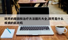 斑秃的原因和治疗方法图片大全,斑秃是什么疾病的前兆吗