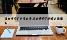 混合痔疮的治疗方法,混合痔疮的治疗方法图解