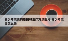 青少年斑秃的原因和治疗方法图片,青少年斑秃怎么治