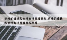 疟疾的症状和治疗方法百度百科,疟疾的症状和治疗方法百度百科图片
