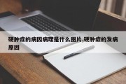 硬肿症的病因病理是什么图片,硬肿症的发病原因
