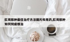 肛周脓肿最佳治疗方法图片和用药,肛周脓肿如何彻底根治