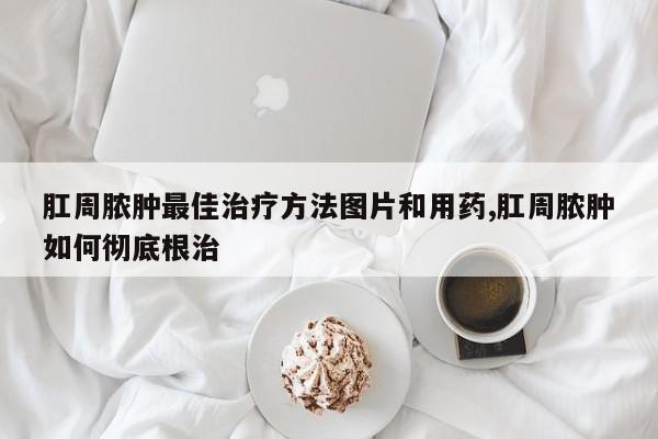 肛周脓肿最佳治疗方法图片和用药,肛周脓肿如何彻底根治