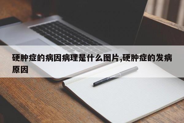 硬肿症的病因病理是什么图片,硬肿症的发病原因