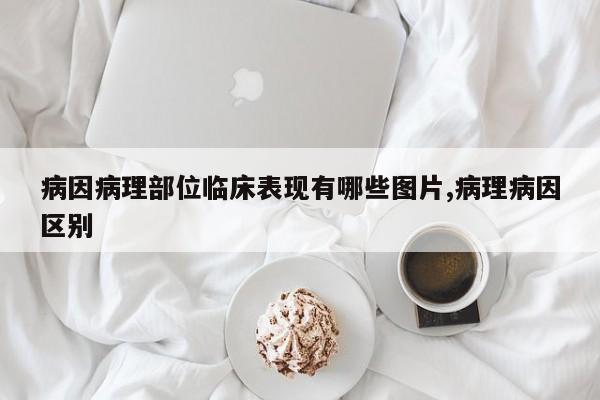 病因病理部位临床表现有哪些图片,病理病因区别
