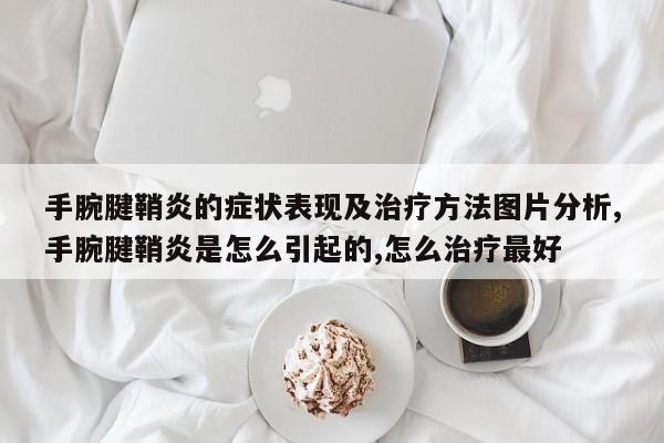手腕腱鞘炎的症状表现及治疗方法图片分析,手腕腱鞘炎是怎么引起的,怎么治疗最好
